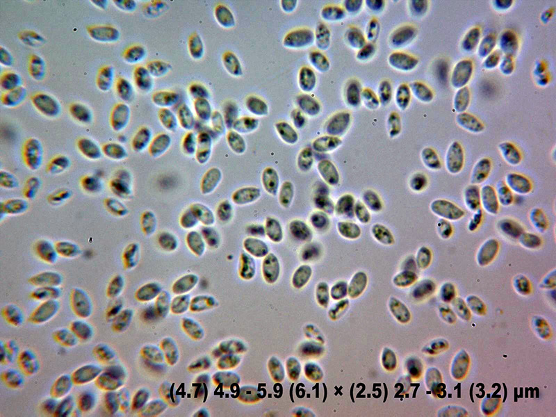 Hydnoide amarilla para determinar.